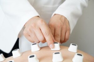 鍼灸が体外受精に与える効果のエビデンスとは？